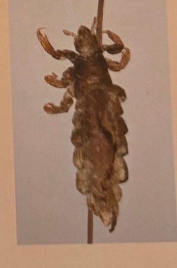 Microscope photo of a head louse on a hair